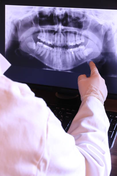 Best Emergency Dental Care for Broken or Chipped Teeth in Millersville, TN