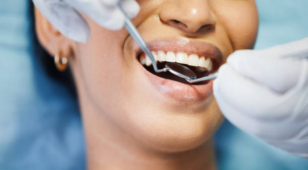 Best Emergency Treatment for Dental Infections or Abscesses in Millersville, TN