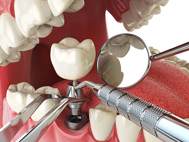 Best Emergency Denture Repair in Millersville, TN